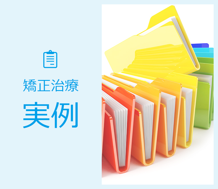 矯正治療実例