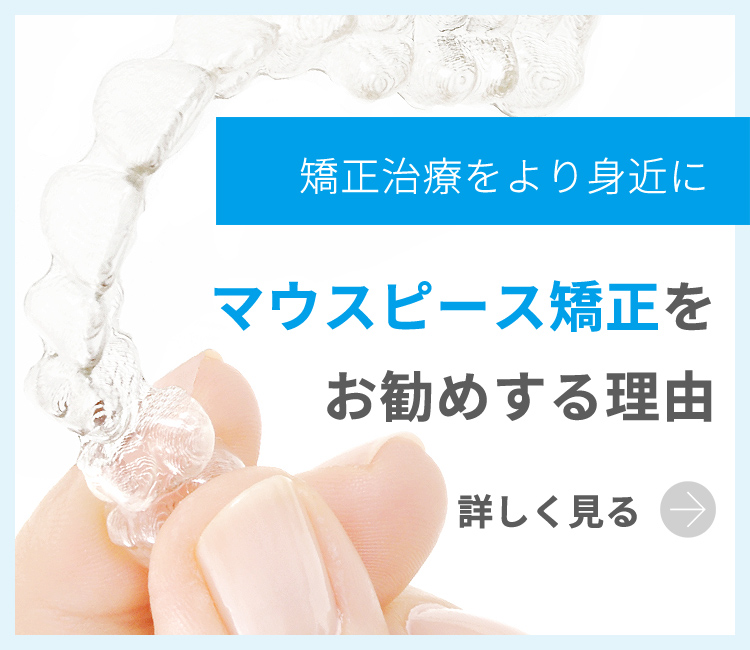 マウスピース矯正をお勧めする理由